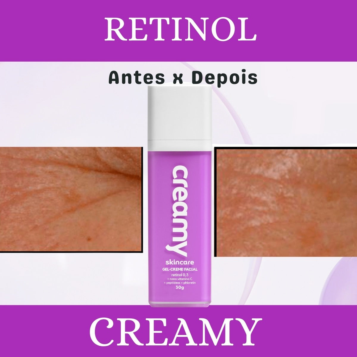 Creamy Retinol 0,3 + Nano Vitamina C + Peptídeos + Phloretin