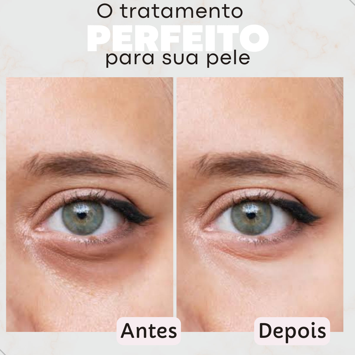 Duo Ácido Mandelico + Eye Cream Creamy Antirrugas Clareador