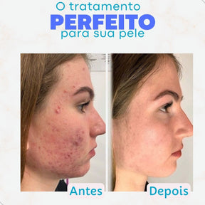 Ácido Glicólico Creamy Anti-idade Renovador Facial Noturno